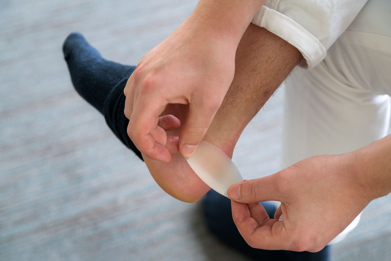 Painful Heel wound on mans feet caused by new shoes. mans hands applying plaster on terrible blister on human heel. Wet bloody painful skin on man foot with medical plaster